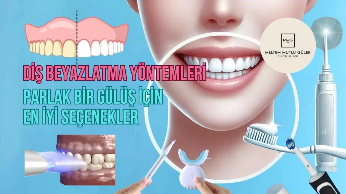 beyazlatıcı diş macunu