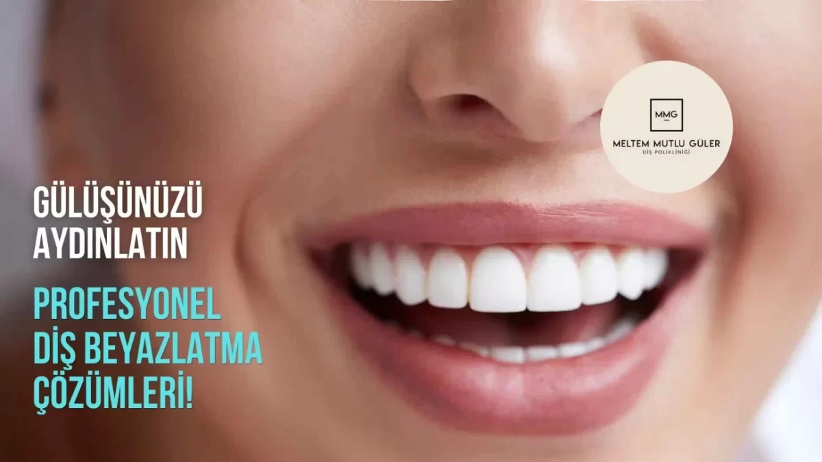 Sakarya | Diş Beyazlatma Çözümleri