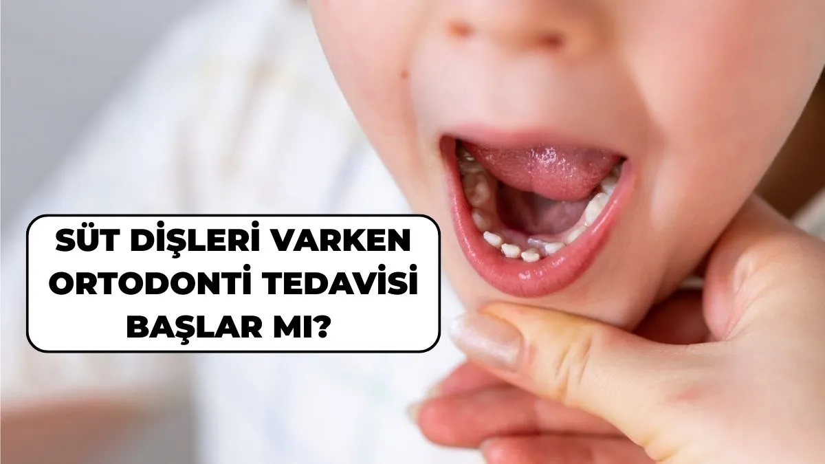 Sakarya çocuk diş hekimine ortodonti muayenesinde süt dişlerini gösteren çocuk hasta