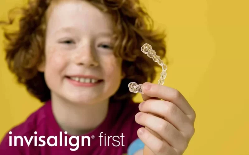 invisalign-first